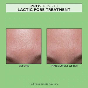 PRO Strength Lactic Pore Treatment Skincare Peter Thomas Roth 